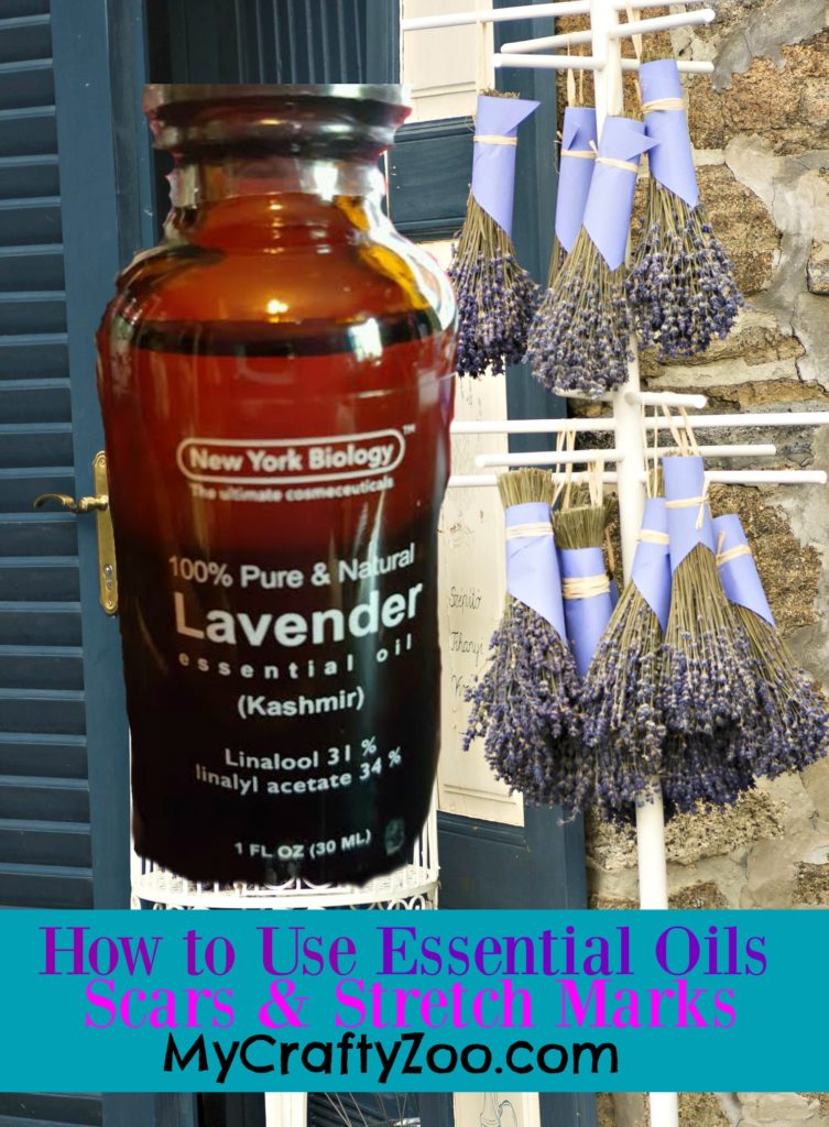 How to Use Essential Oils For Scars & Stretch Marks with 
